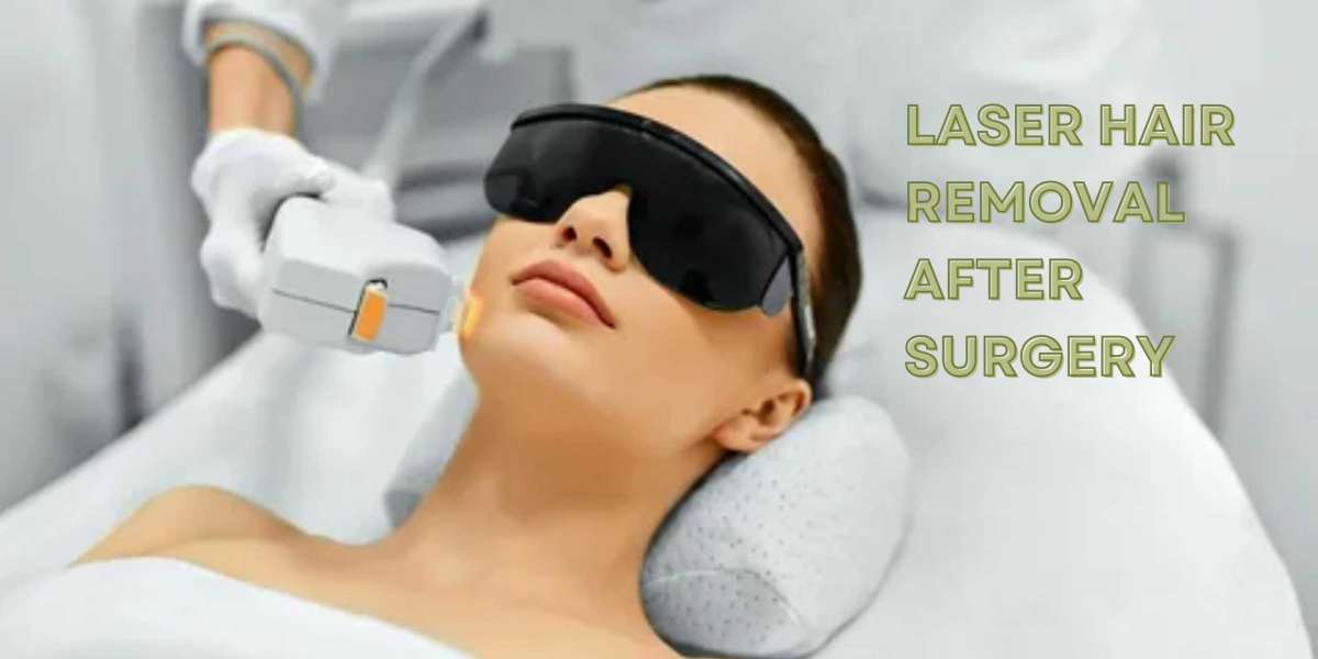 Laser Hair Removal Post-Surgery Tips