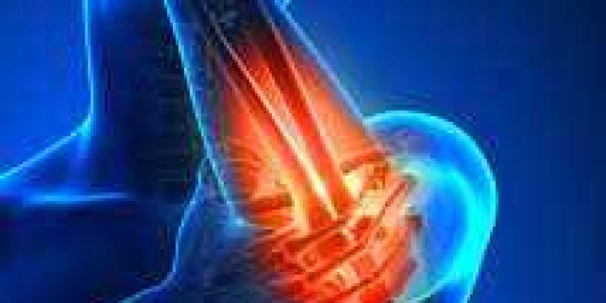 Understanding Forearm Pain: Causes and Solutions