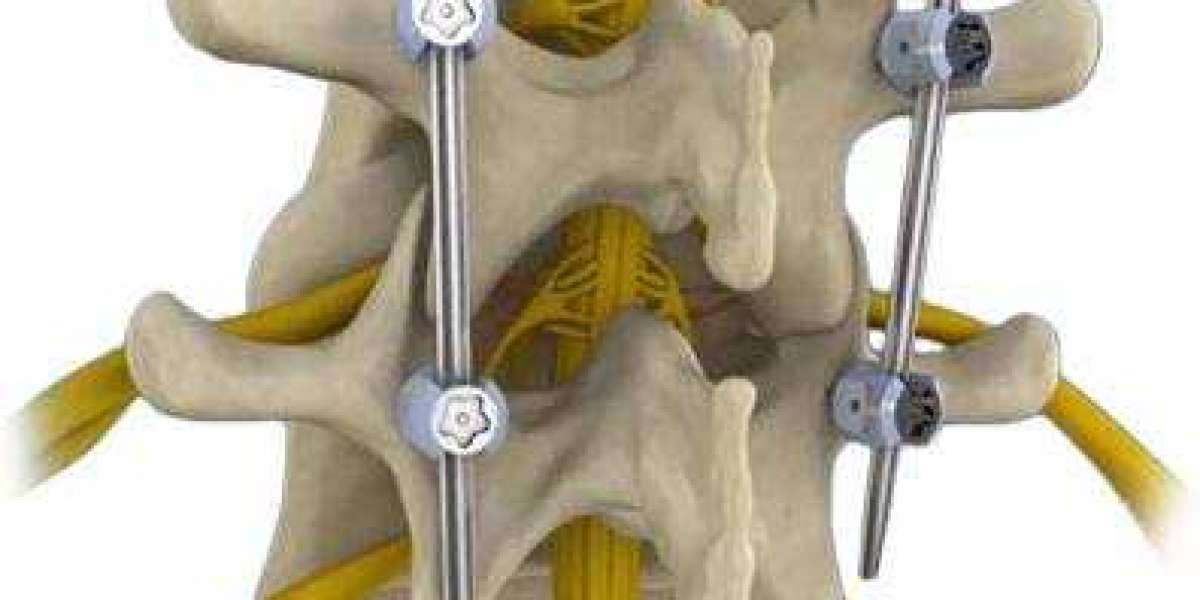 Understanding Spine Decompression Surgery: Relief from Chronic Back Pain
