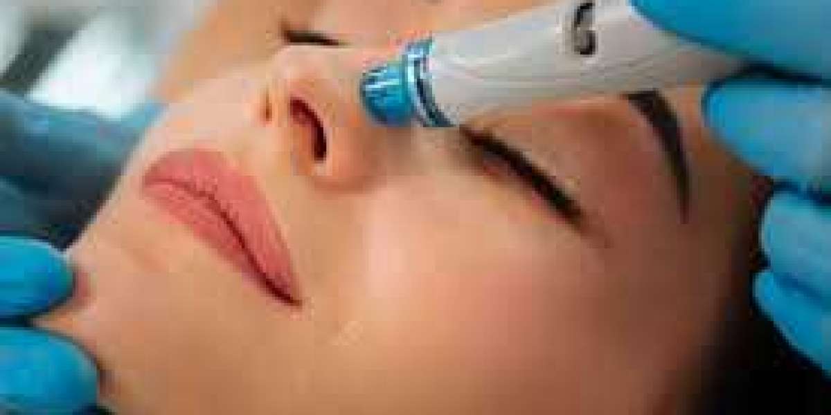 The Definitive Hydrafacial Dublin Experience: Benefits and What to Anticipate