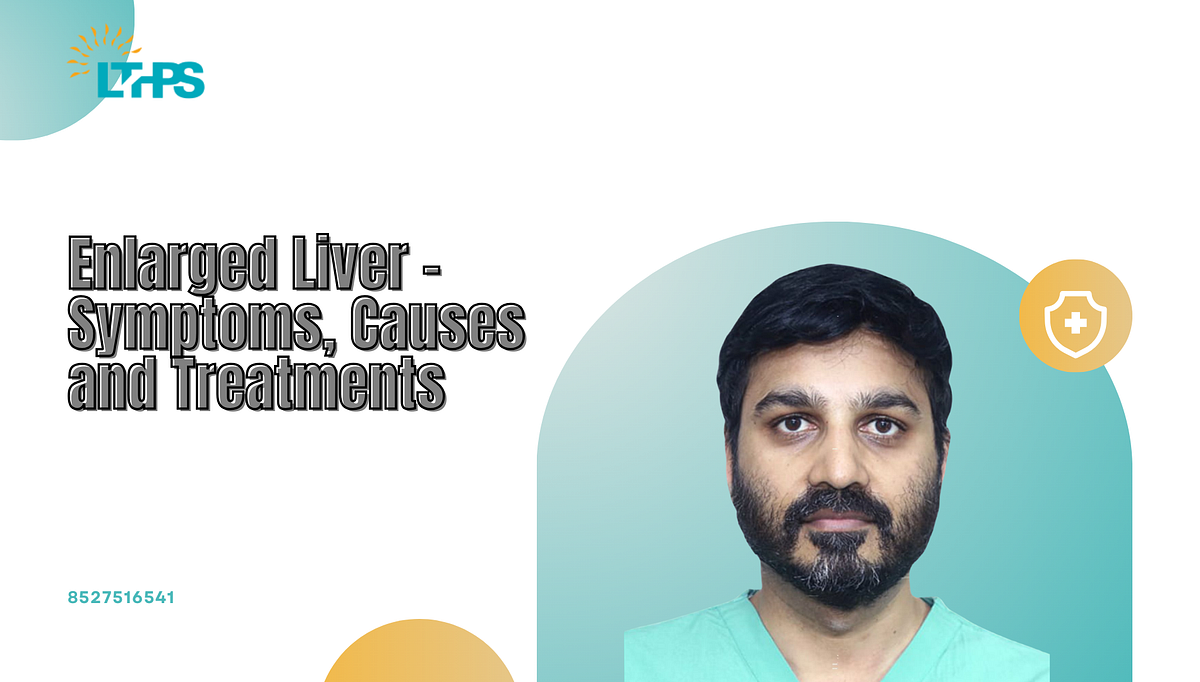 Enlarged Liver — Symptoms, Causes and Treatments | by Transplantationliver | Sep, 2024 | Medium