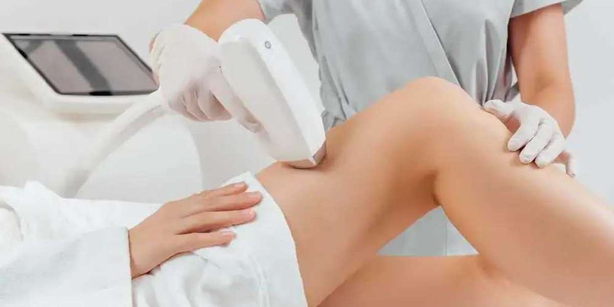 Laser Hair Removal Frisco TX at Sleek Laser Solutions