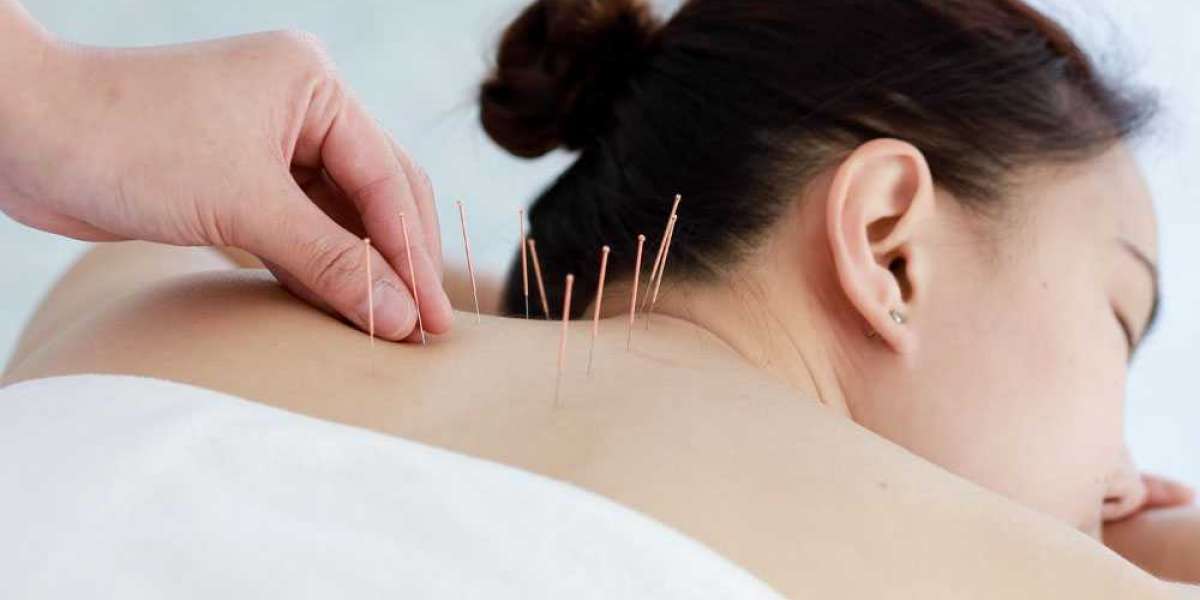 Enhancing Reproductive Health with Acupuncture for Fertility